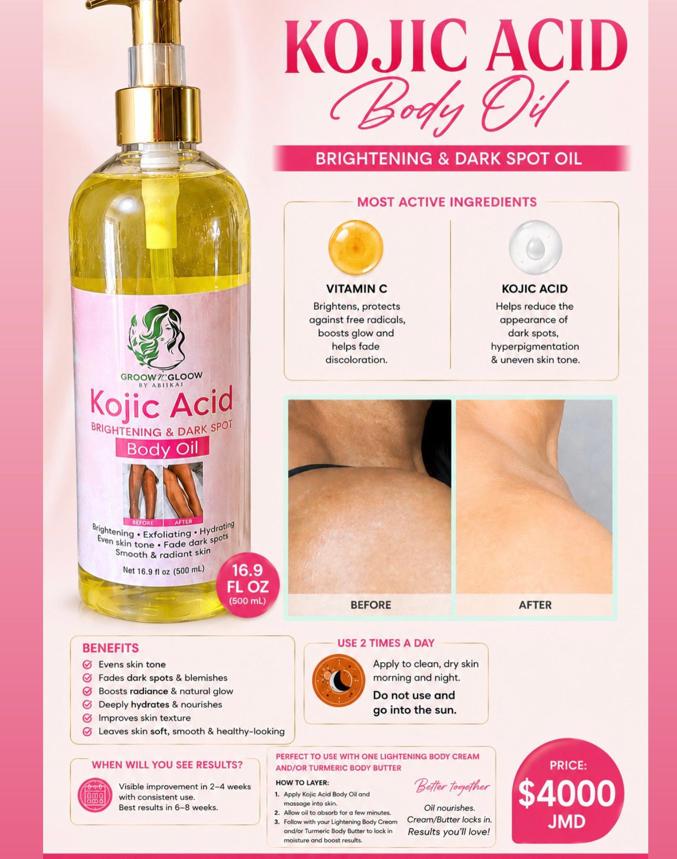 Kojic Acid Body Oil 16floz
